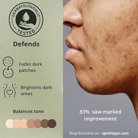 Lumi Bliss Brightening Serum for Pigmentation, Dark Spots, Tanning, Uneven Skin Tone | Bikini, Underarm, Neck & Inner Thigh Care | Fragrance-Free | For Women & Men | 50 ml